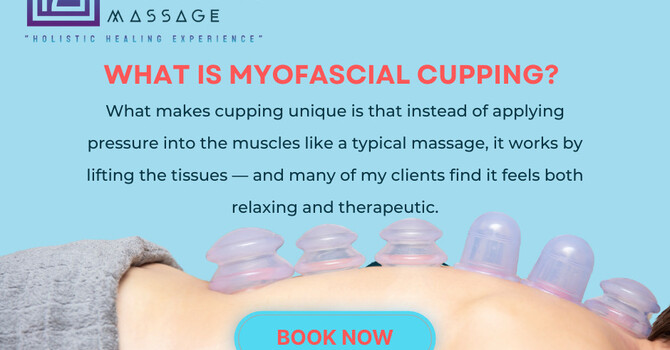  Experience Healing from the Inside Out with Cupping Therapy image
